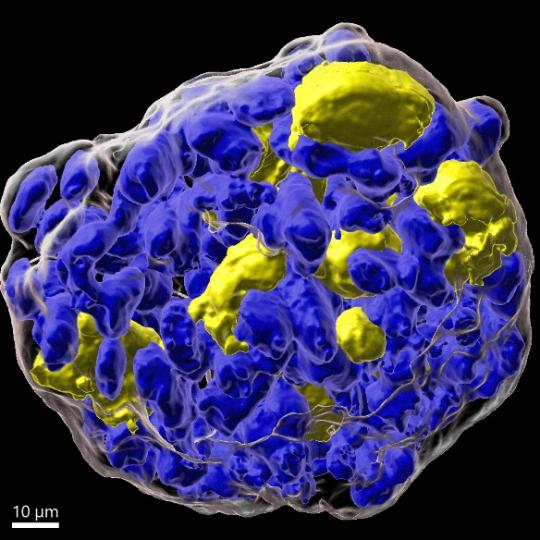 Organoïdes thyroïde humaine 