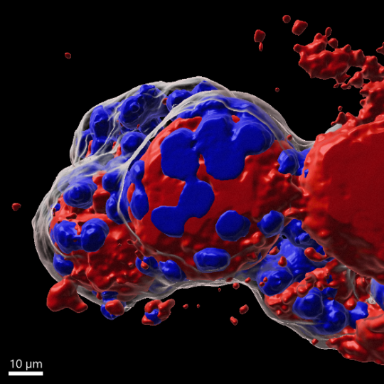 Organoïdes thyroïde humaine