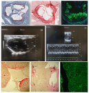 rayonnements ionisants, faibles doses, effets sur la santé, cardiovasculaire, cérébral, transgénérationnel, cancer, intégration des données, AOP  Les principales activités de recherche du LRTOX s'inscrivent dans les priorités scientifiques de l'IRSN et visent à comprendre les réponses biologiques aux faibles doses de rayonnements et les mécanismes conduisant à des pathologies non cancéreuses et cancéreuses.