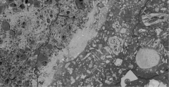 Image au microscope éléctronique à balayage d'une matrice cimentaire